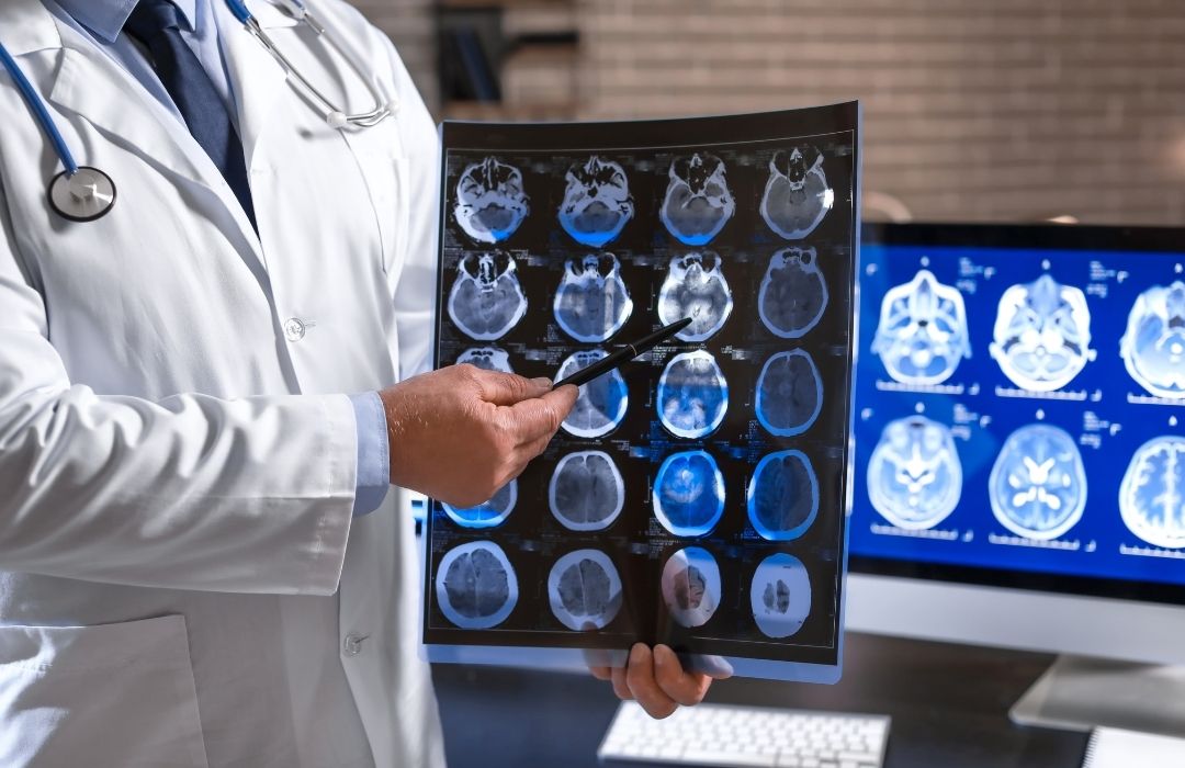 זעזוע מוח תסמינים סיבות ודרכי הימנעות