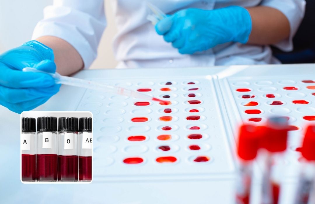 סוגי דם נדירים, איזה סוגי דם יש ומי יכול לתרום למי, יצאנו לעשות בדיקה מקיפה של סוגי הדם בישראל ומה המשמעות של כל אחד.